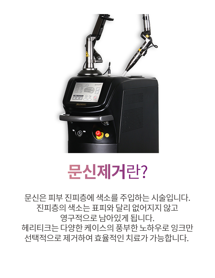 문신제거란?