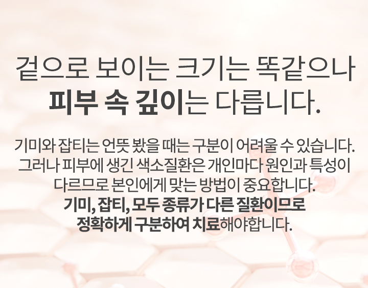 겉으로 보이는 크기는 똑같으나 피부 속 깊이는 다릅니다.