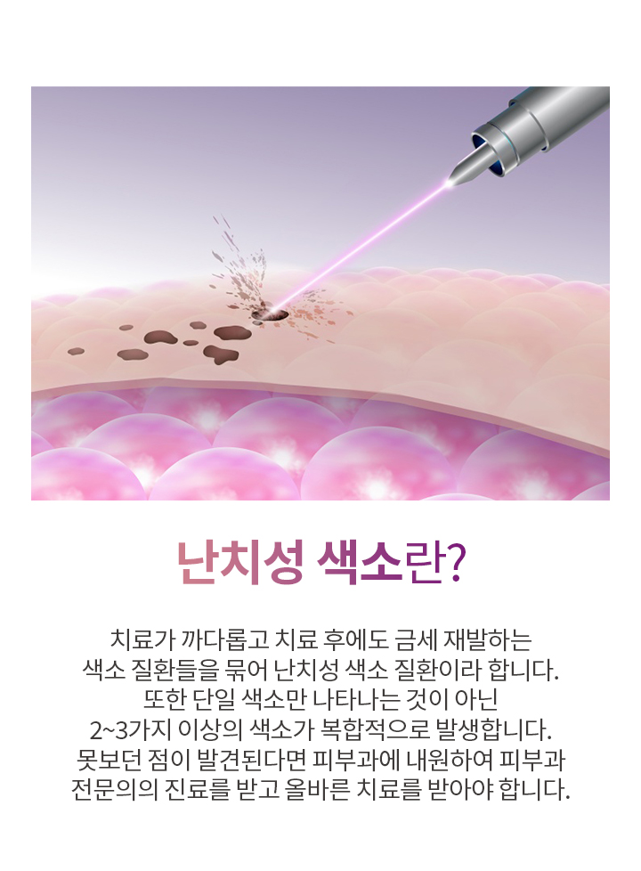 난치성 색소란?