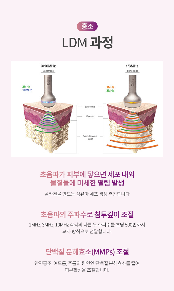 LDM 과정