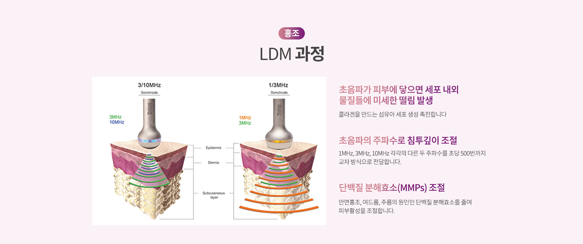 LDM 과정