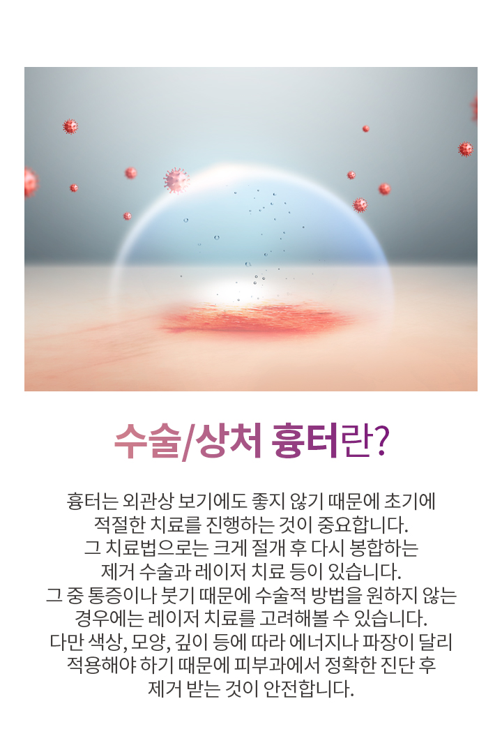 수술/상처 흉터란?