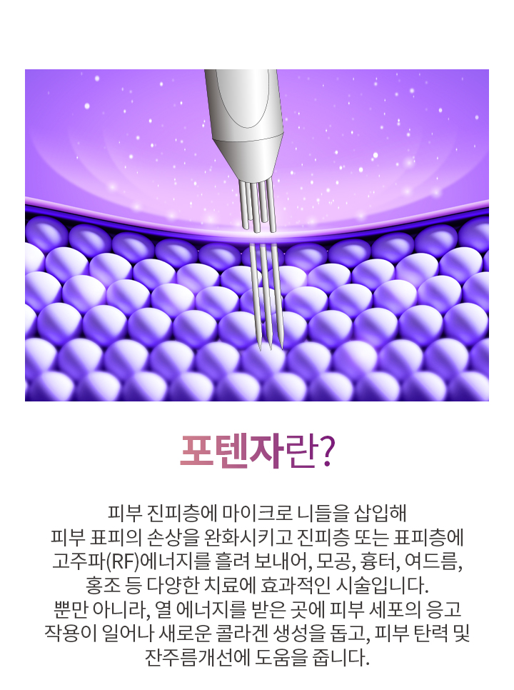 포텐자란?