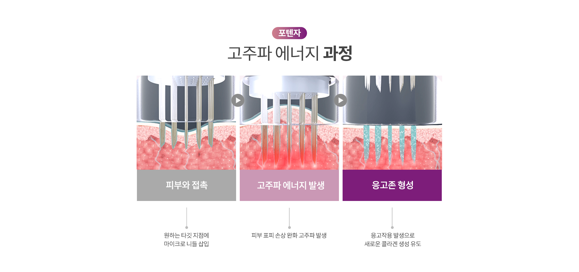 포텐자 고주파 에너지 과정