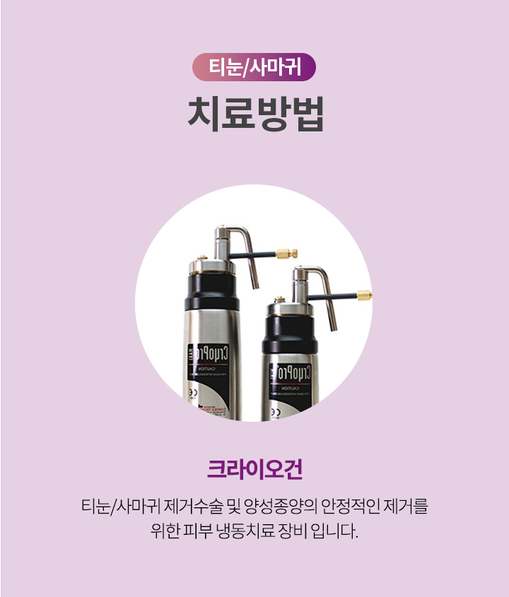 티눈/사마귀 치료방법