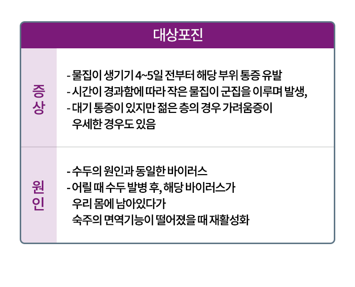 대상포진 증상과 원인